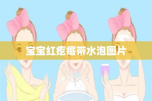 宝宝红疙瘩带水泡图片