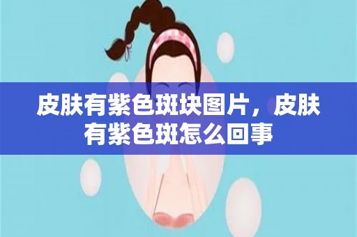 皮肤有紫色斑块图片，皮肤有紫色斑怎么回事